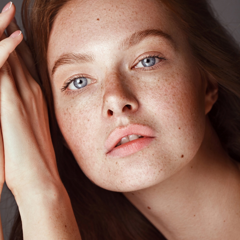 Skin care. Woman with beautiful freckles and healthy hydrated skin. Sensitive girl model with natural makeup. High quality image